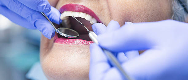 Best Emergency Tooth Extraction in Caledonia, MS
